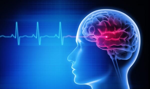 Peptides for Brain Health - Consultation