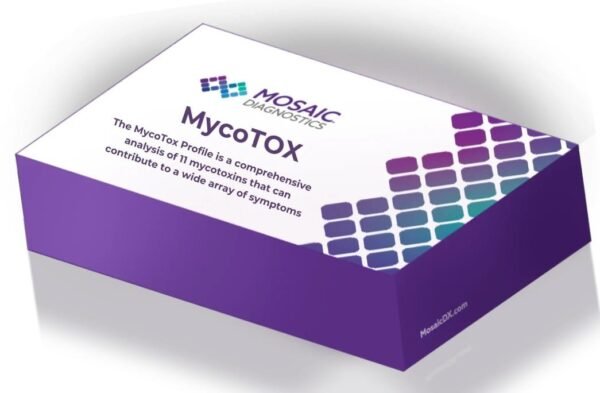 Urine Test of Mycotoxins